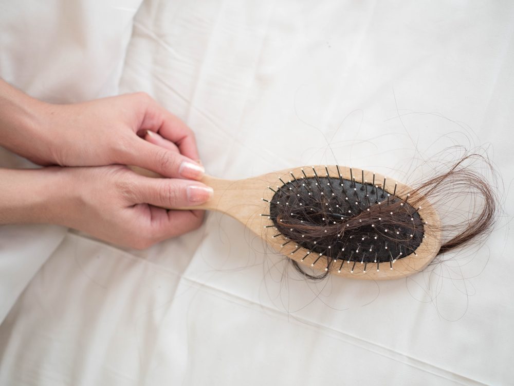 Hair Loss 16 Surprising Reasons Your Hair Is Falling Out The Health
