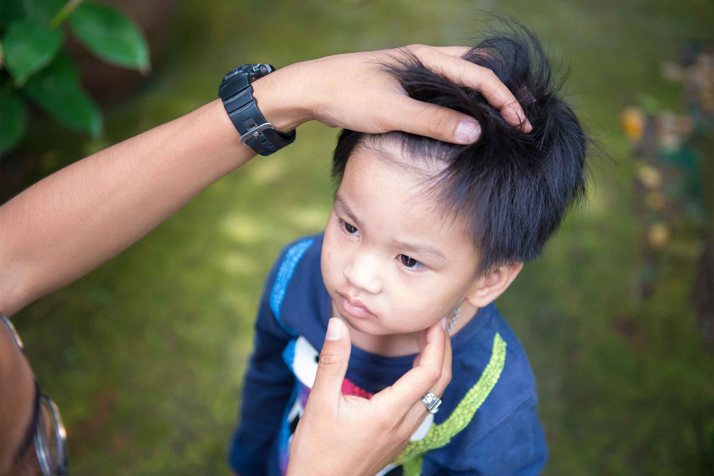 7 Clear Signs Your Child Has Head Lice