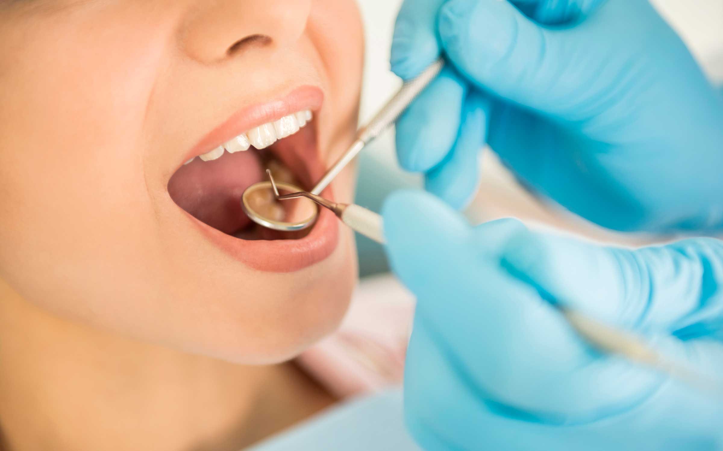 10 Surprising Health Problems Dentists Can Find First