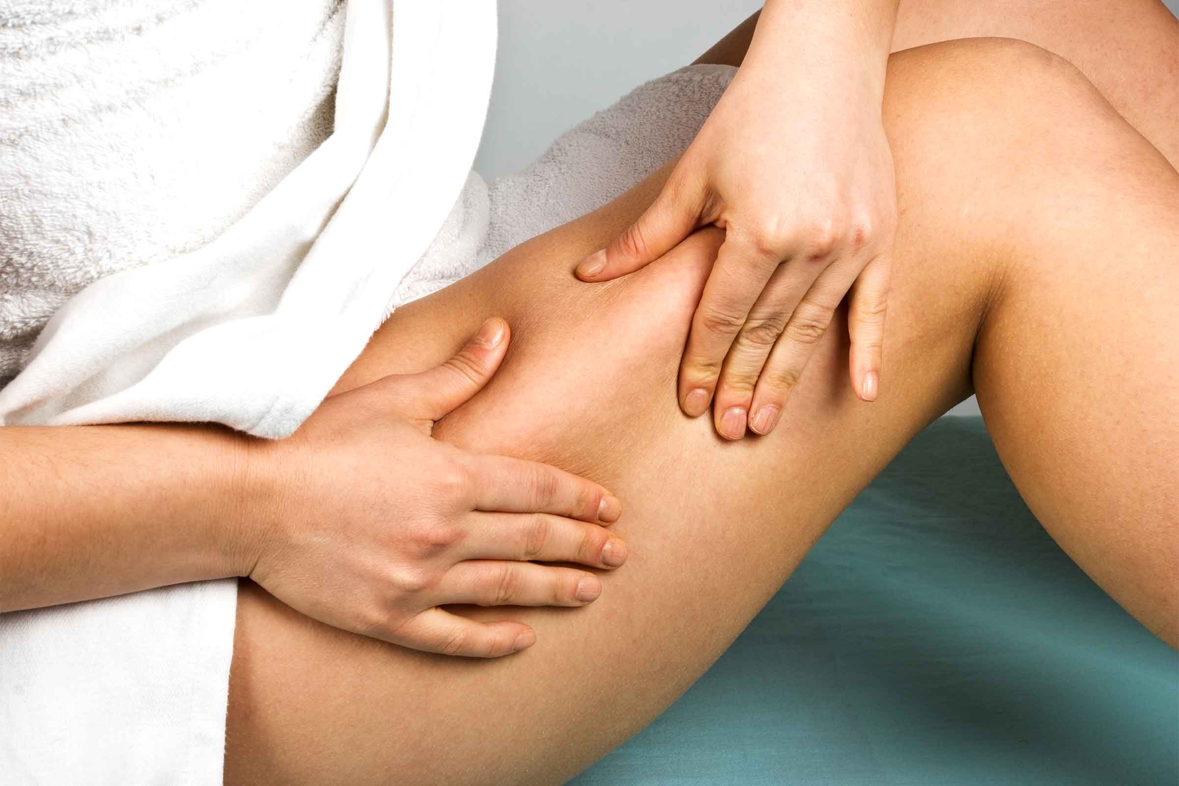 8 Things Dermatologists Wish Women Knew About Cellulite