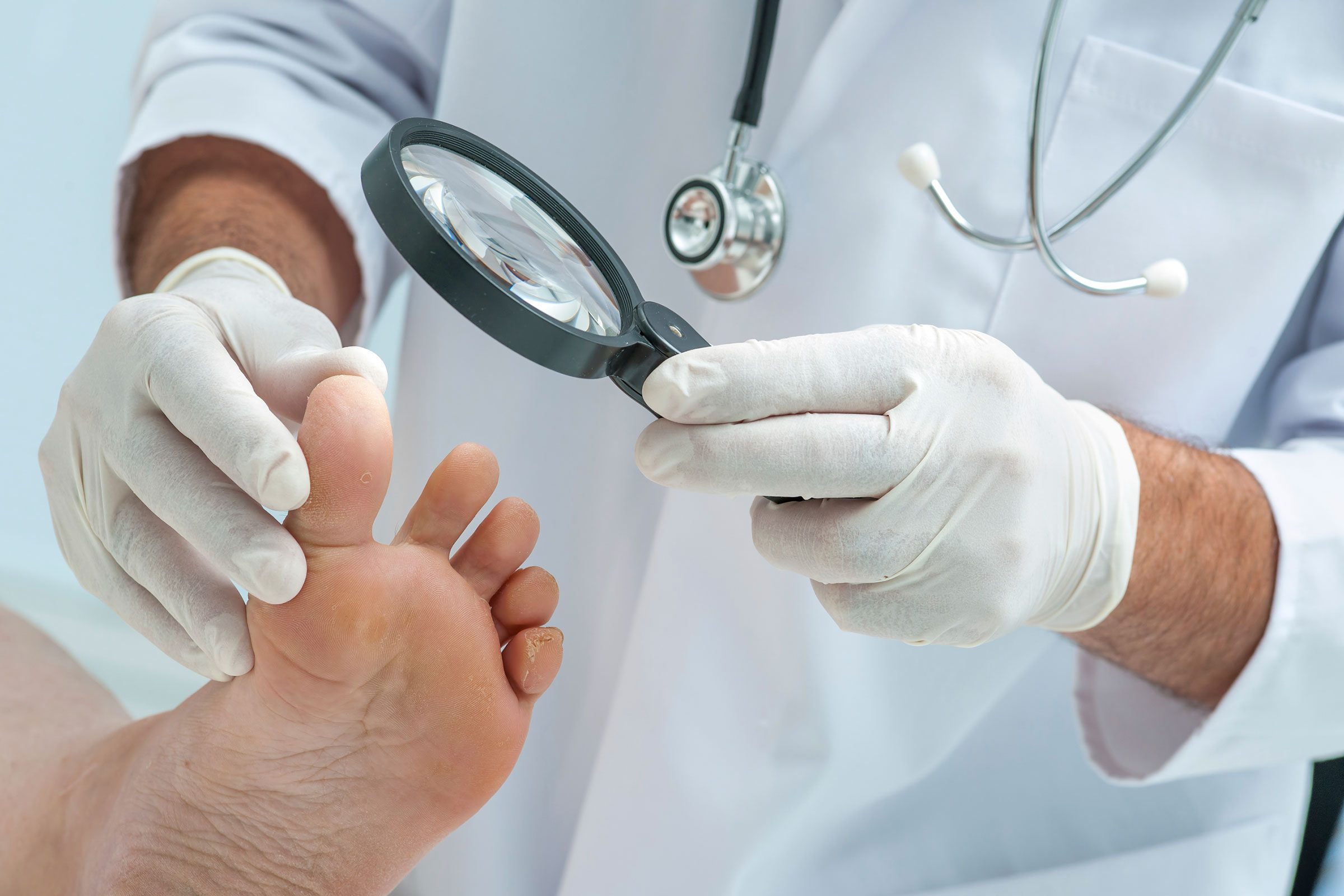 10 Subtle Signs of Disease Your Feet Can Reveal
