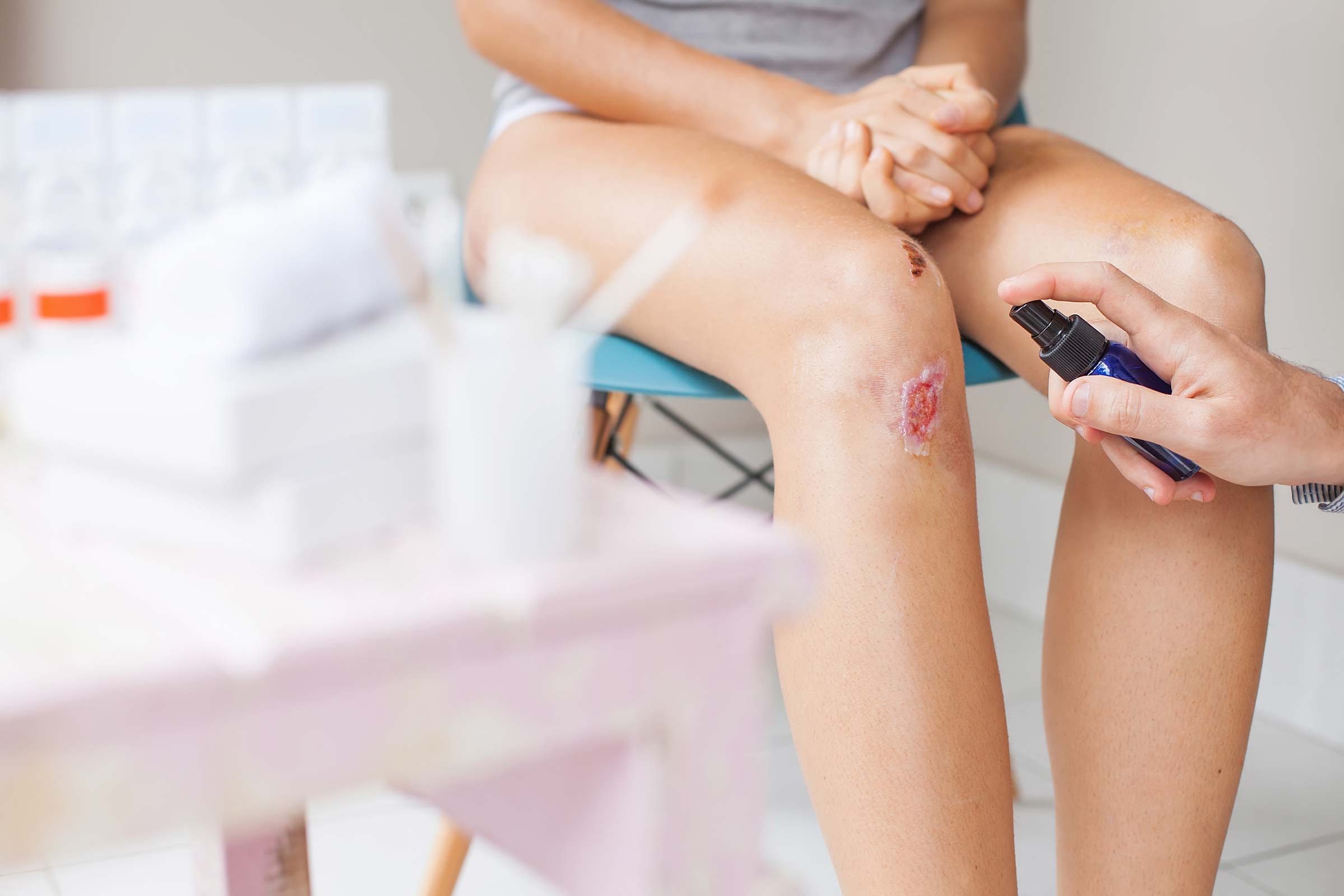 9 Signs of an Infected Cut or Scrape You Should Never Ignore