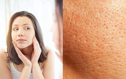 11 Myths and Truths About Large Pores that Will Change Your Face