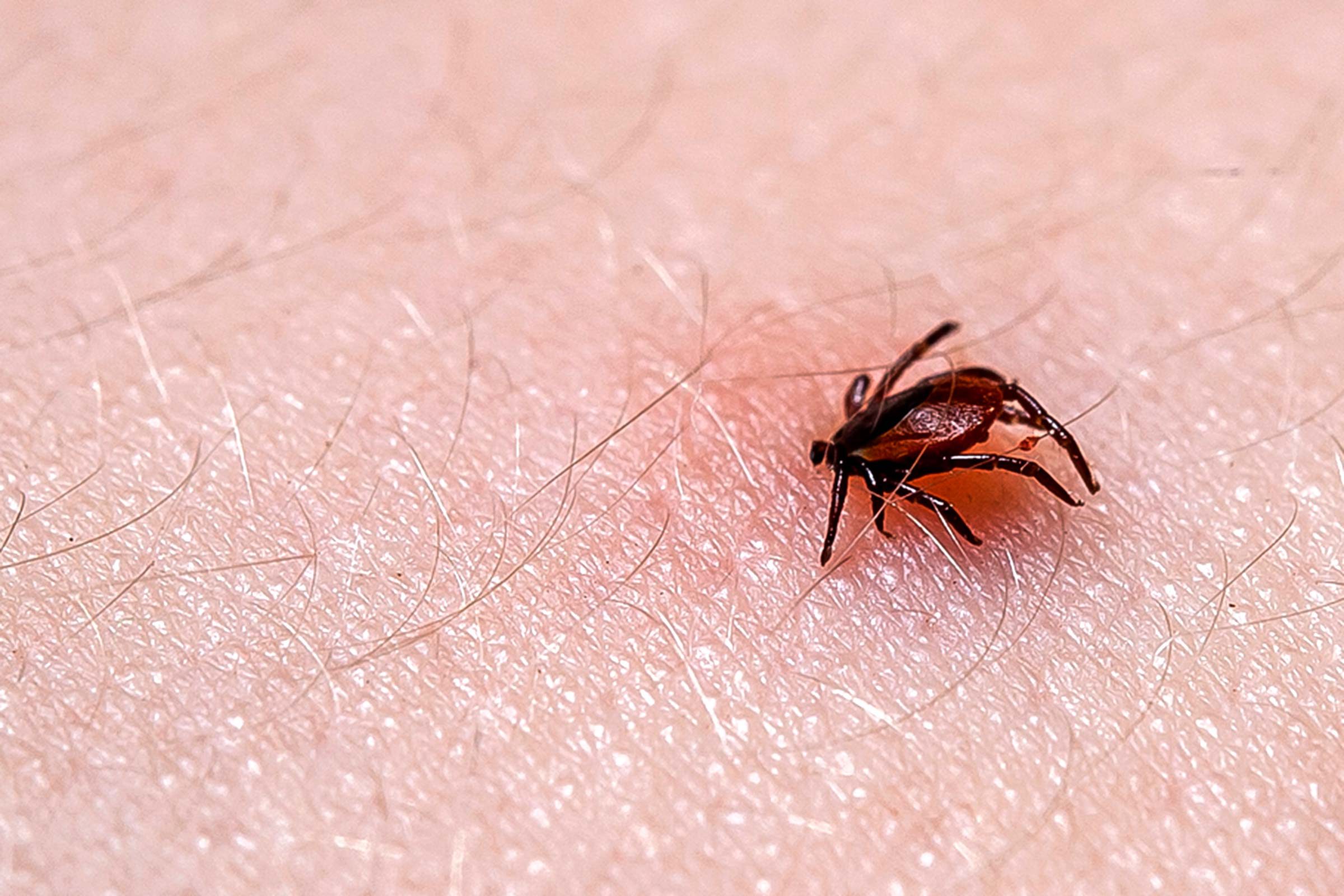 Tick Borne Diseases You Need To Know About The Healthy