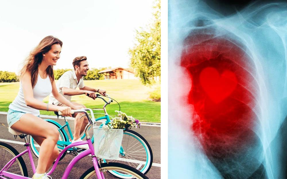 How to Prevent Heart Disease and Stroke: 30 Ways to Reduce Your Risk