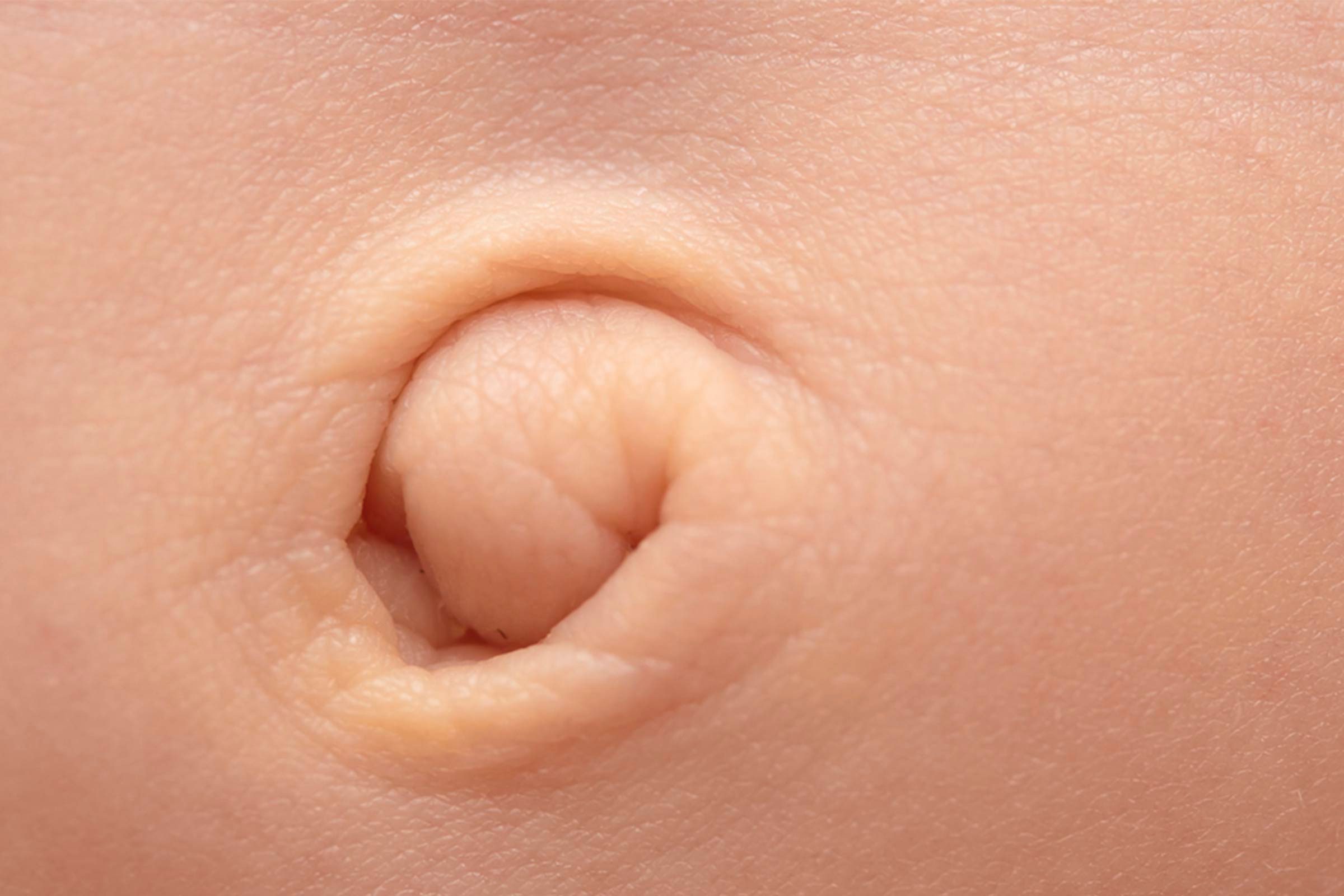 Your Belly Button Things You Didn t Know About Your Navel The