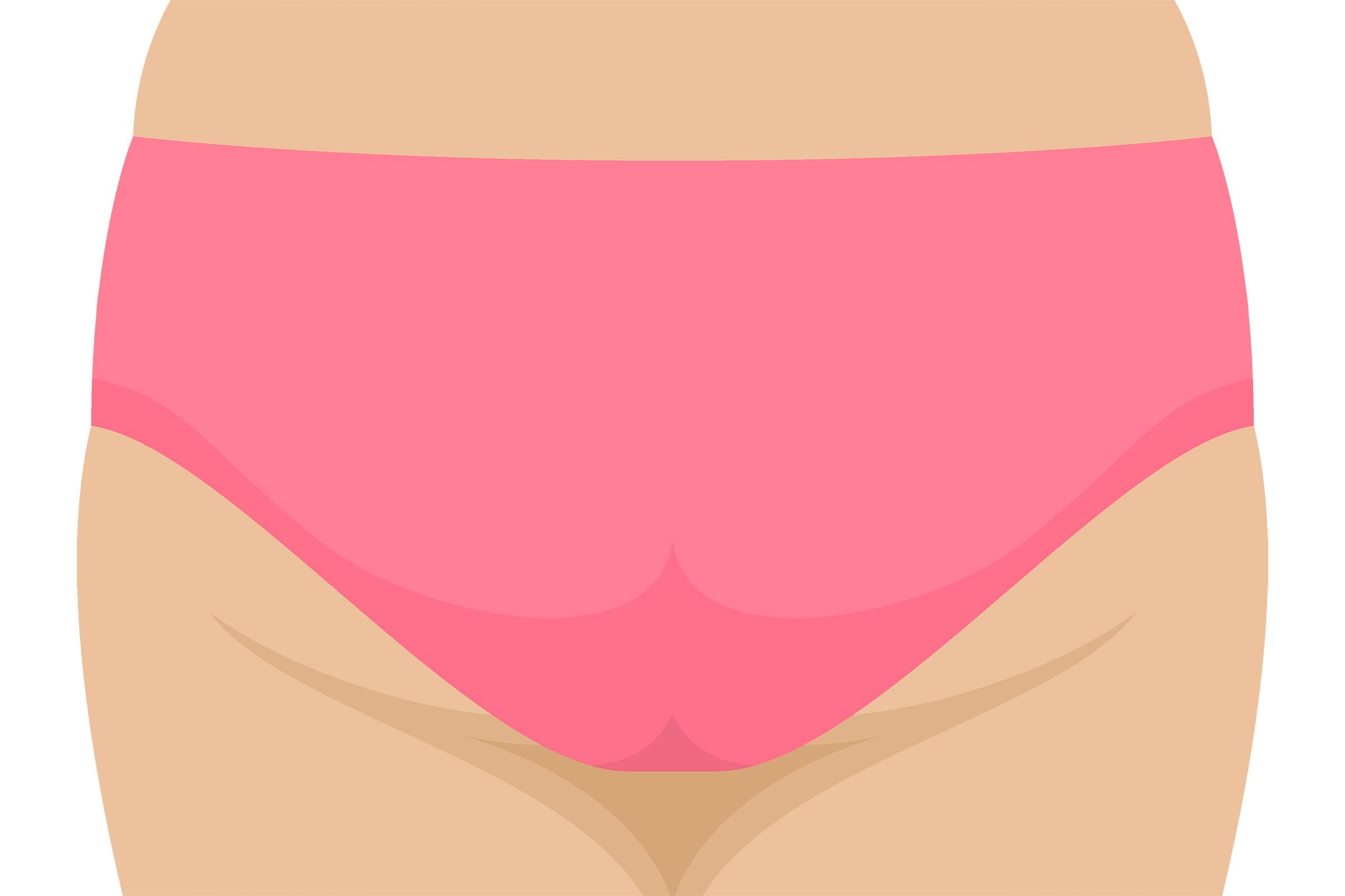 Vaginal Acne: How to Treat Acne in Your Private Parts