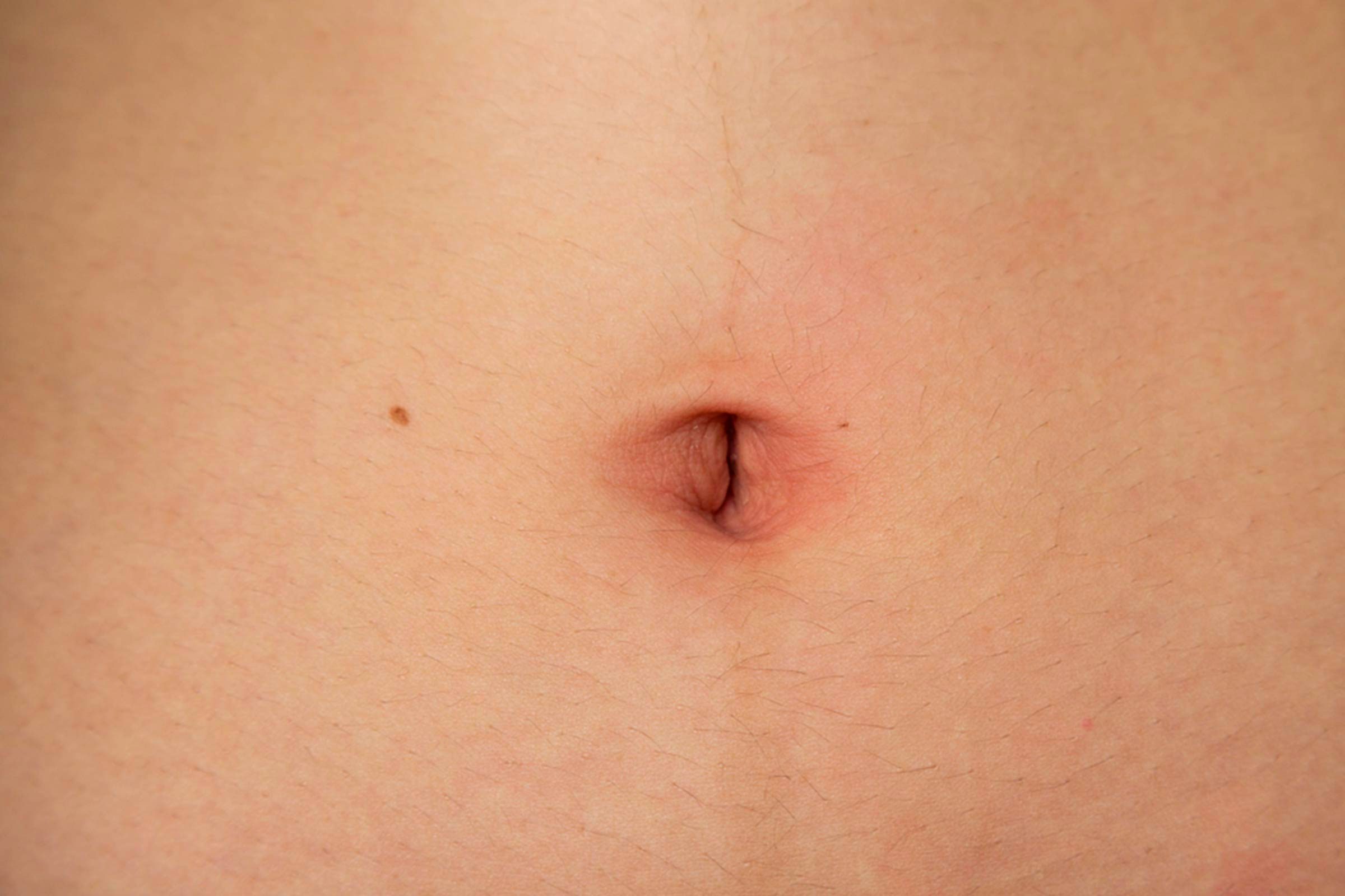 Your Belly Button Things You Didn t Know About Your Navel The