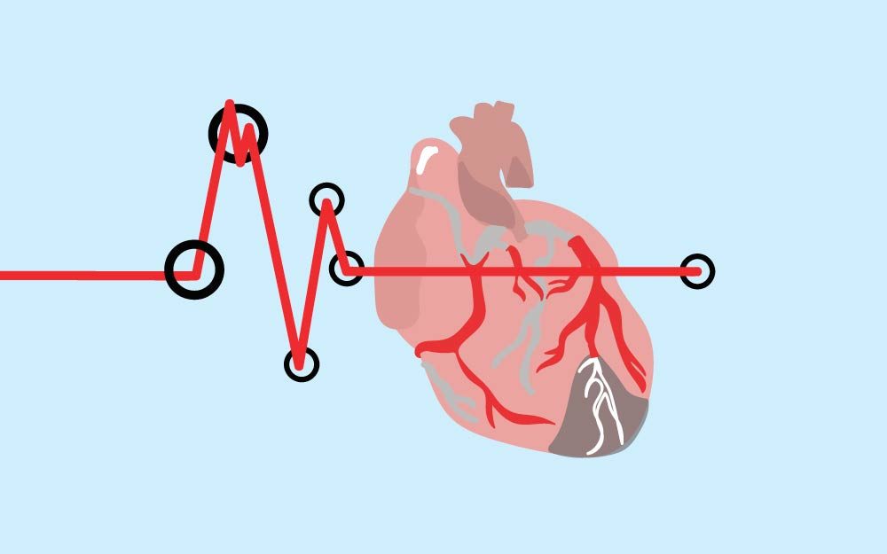 This Infographic Shows What a Heart Attack Looks Like Depending on Your Race and Gender