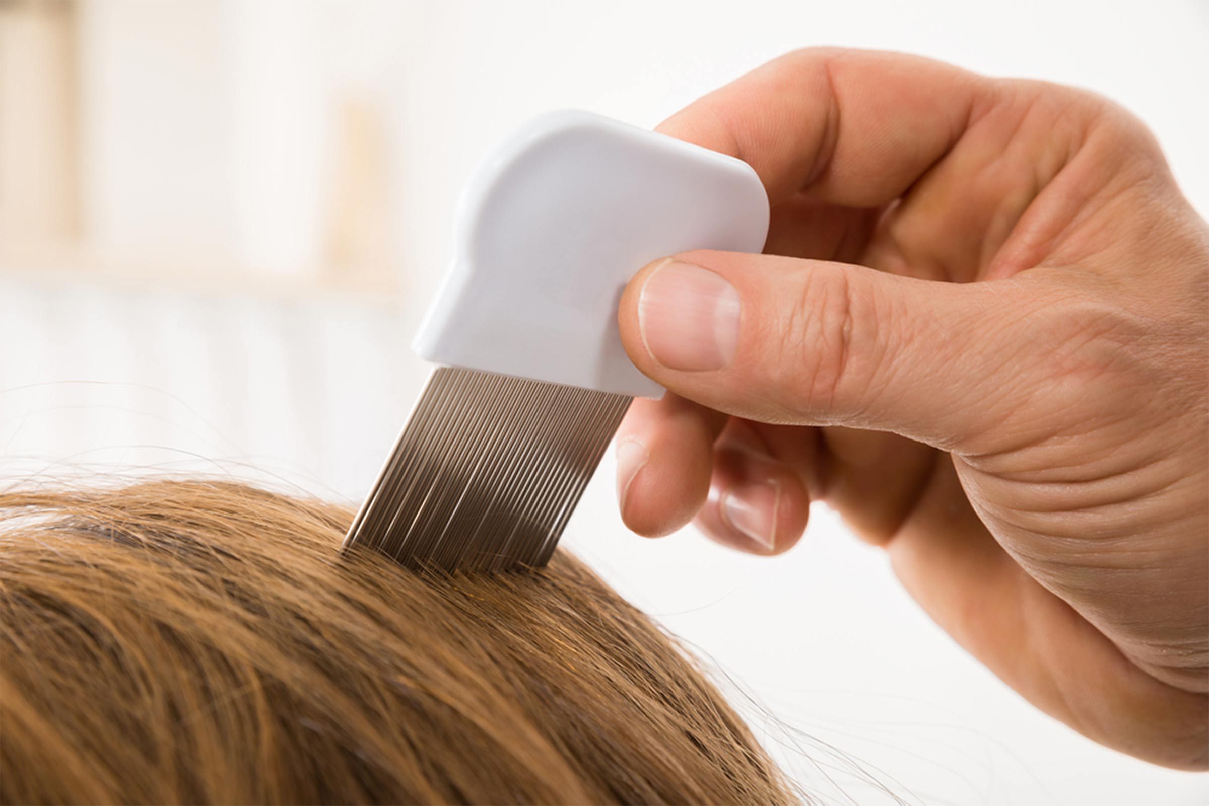 Reasons for Your Itchy Scalp (Besides Head Lice) | The Healthy
