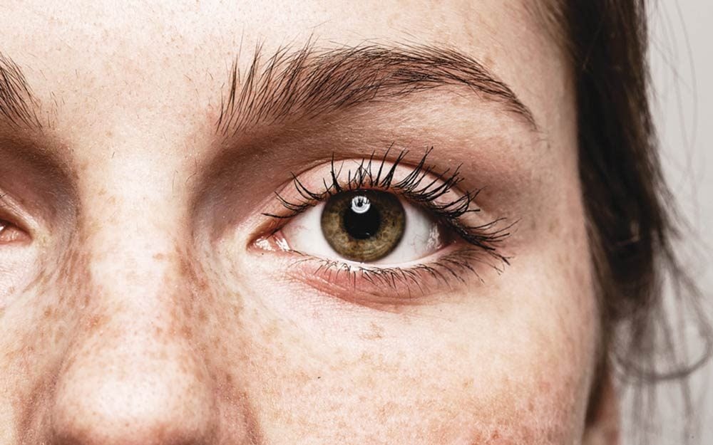 Yes, Eye Freckles Are a Thing—and This Is What They Reveal About Your Health