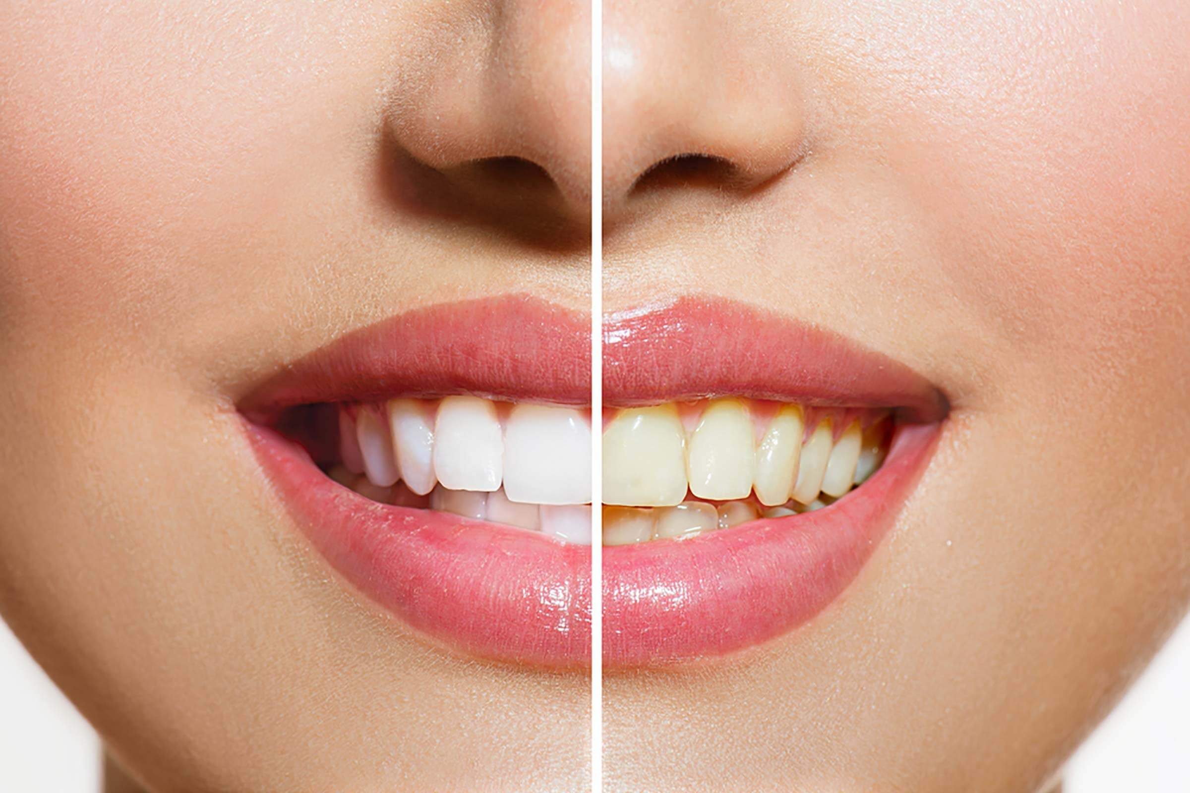 Yellow Teeth Are Actually Stronger Than Bright White Teeth—Here’s Why