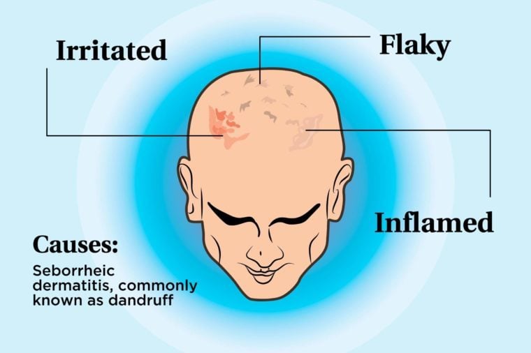 Image result for scratching scalp ILLUSTRATION