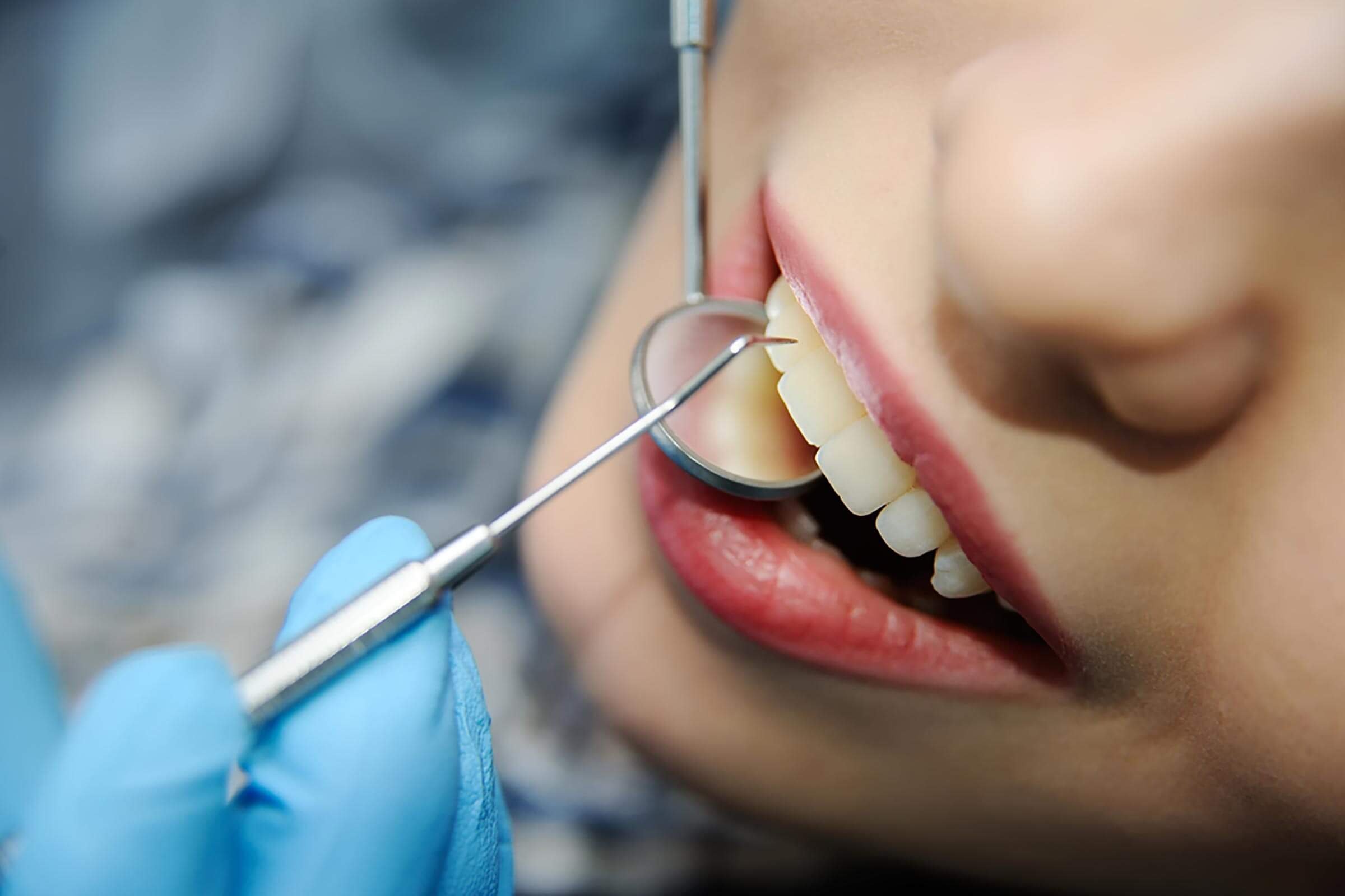 35 Secrets Your Dentist Won't Tell You