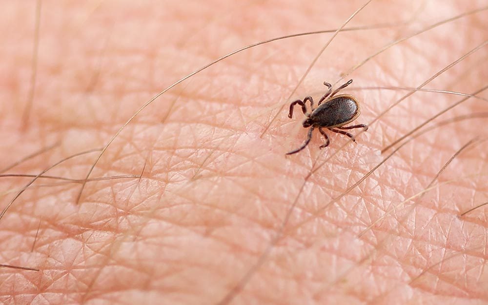 10 Things to Do Right Now If You've Been Bitten By a Tick