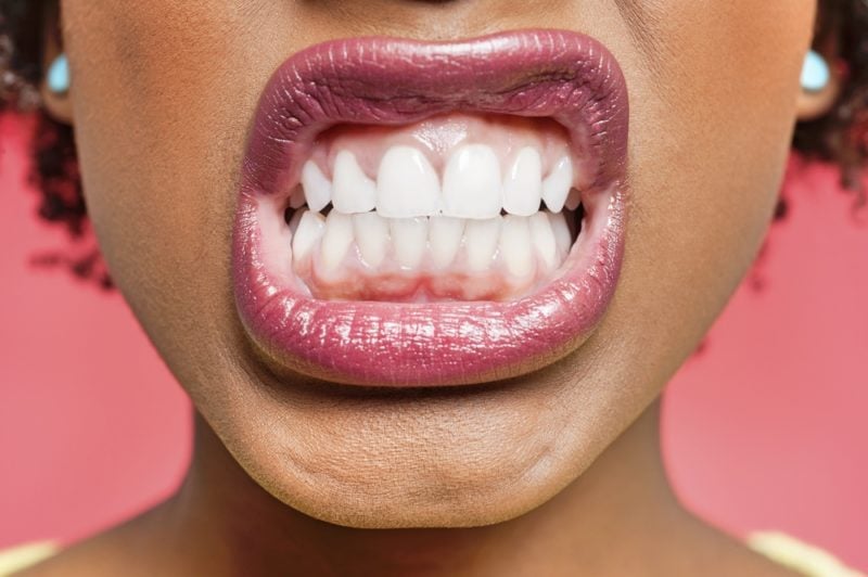7 Surprising Home Remedies for Teeth Grinding