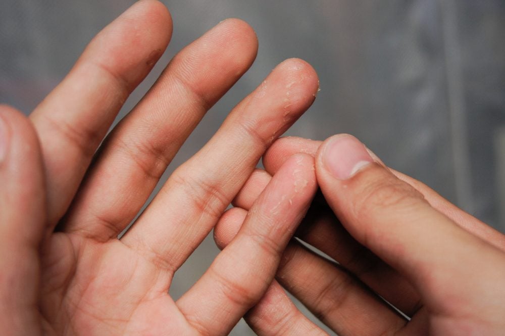 5 Signs You Could Have a Pinched Nerve