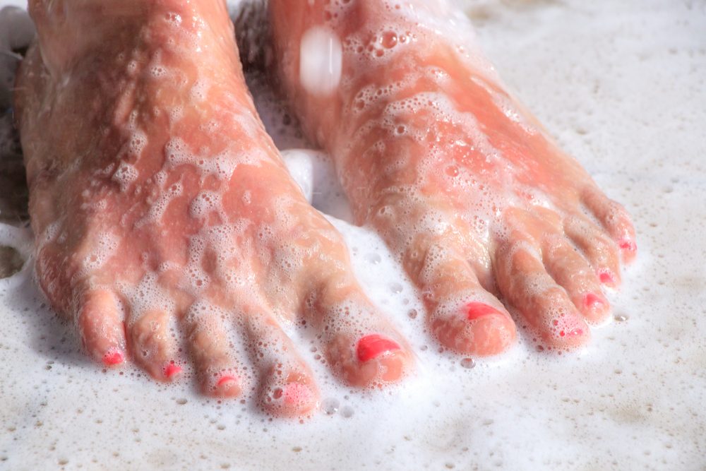 athlete-s-foot-treatment-home-remedies-that-work-the-healthy