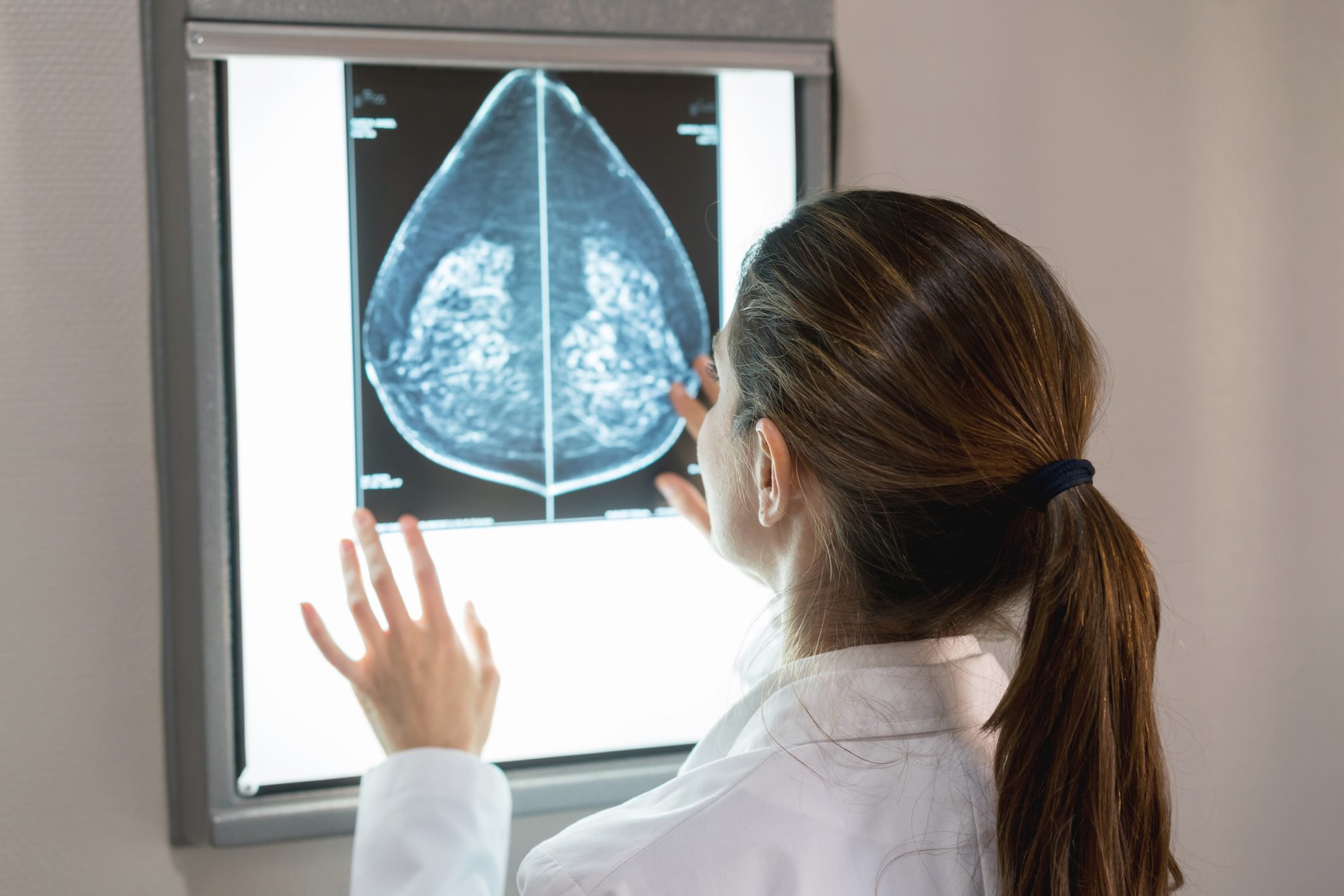 Abnormal Mammogram? 7 Questions You Must Ask