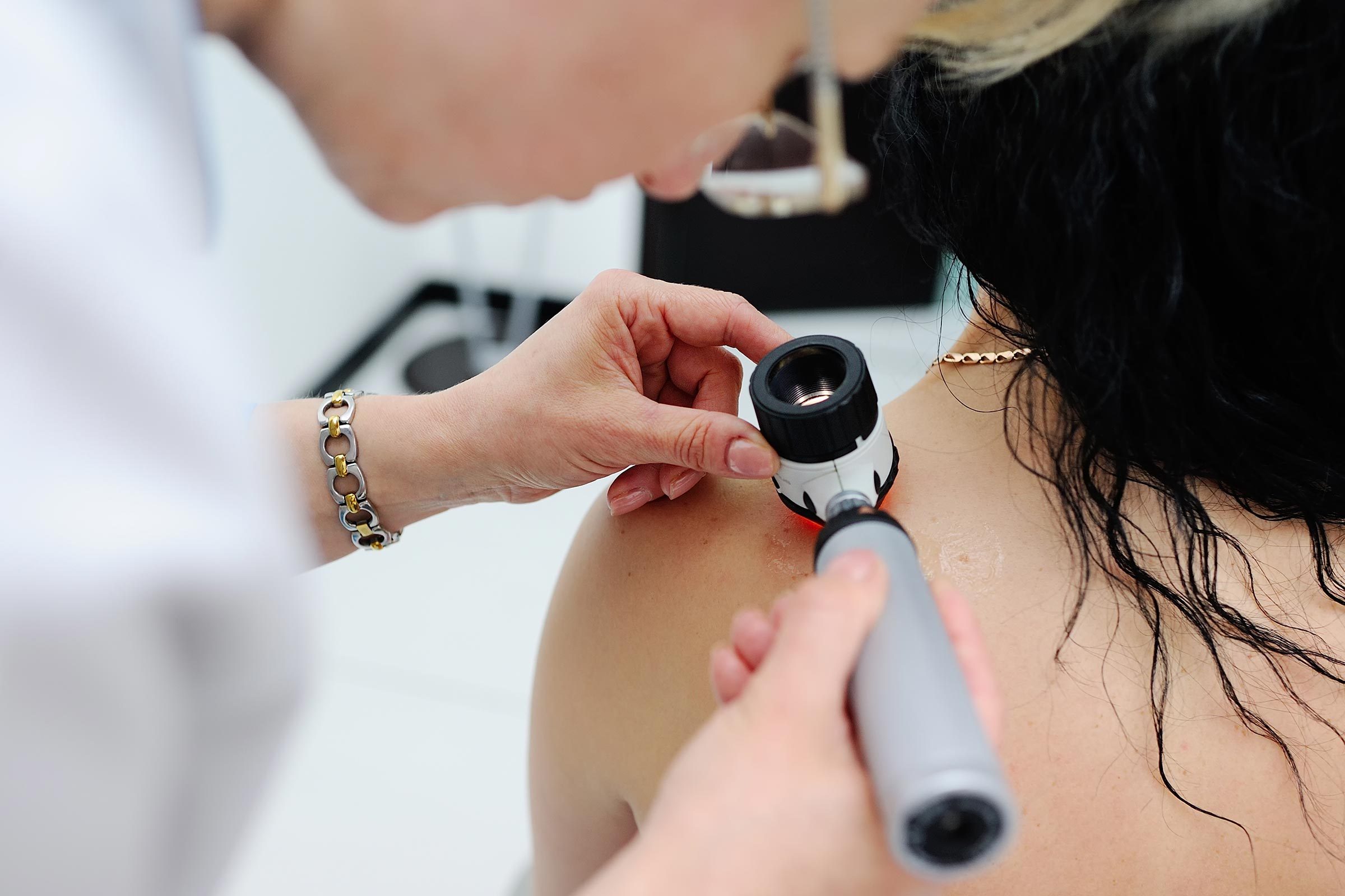 12 Silent Signs of Skin Cancer You're Probably Ignoring