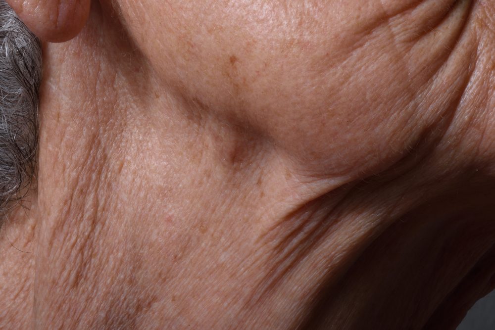 What Bumps On Your Neck Really Mean The Healthy