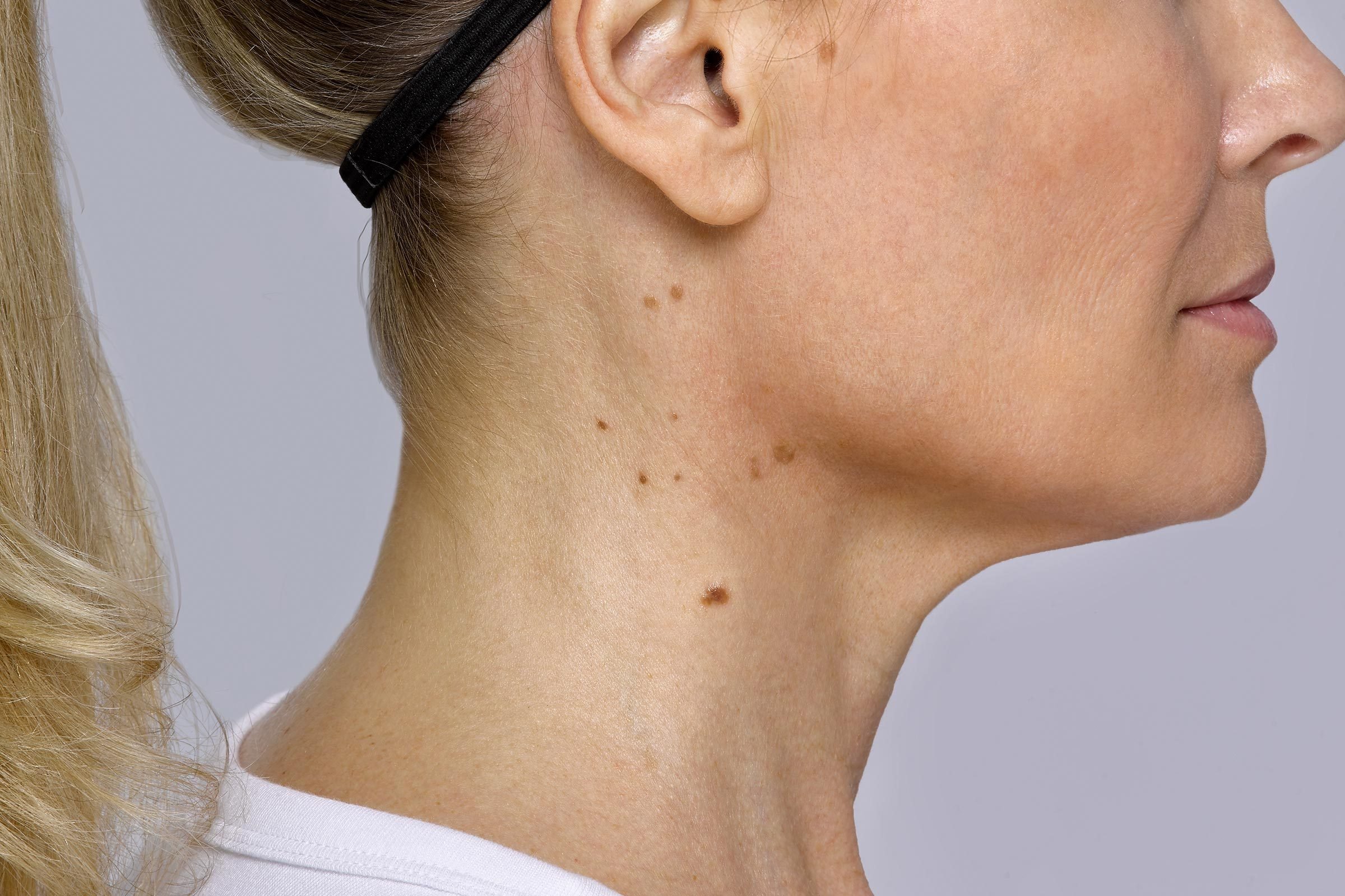 What Bumps On Your Neck Really Mean The Healthy