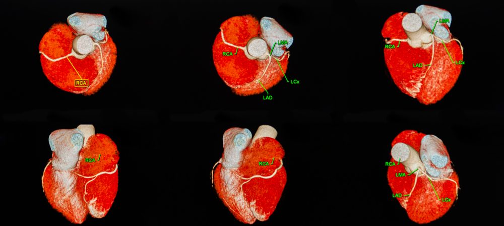 common-infections-that-can-raise-your-heart-attack-risk-the-healthy