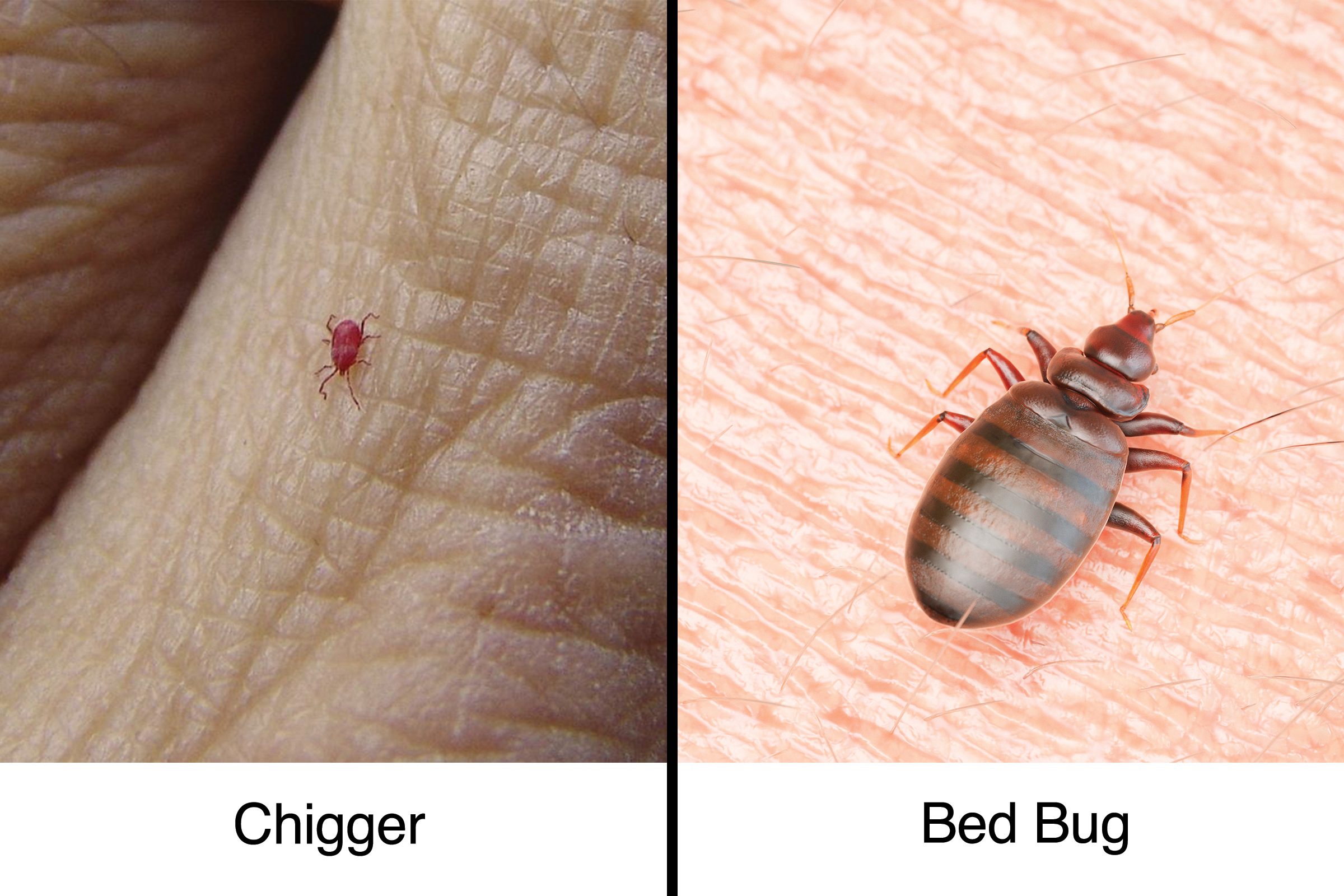 bed bug bites on genital area