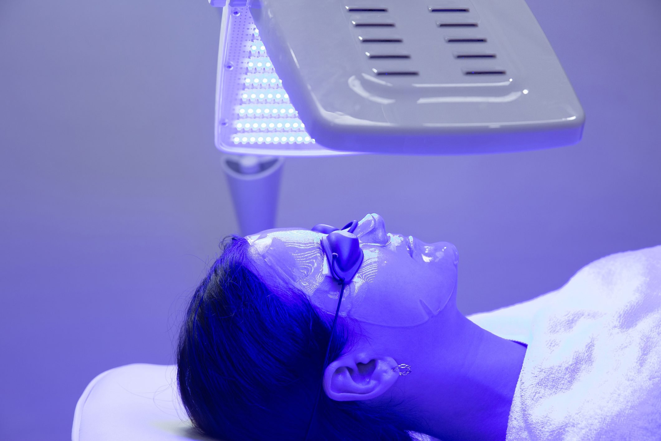 Does Blue Light Therapy for Acne Work?