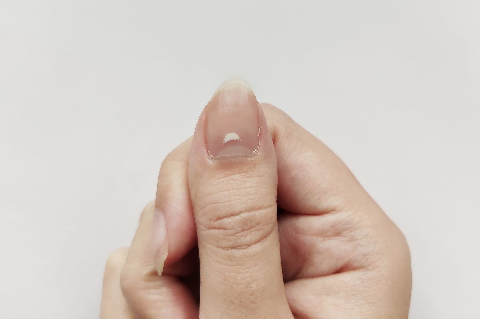 Esto es lo que significa cuando tienes manchas blancas en las uñas