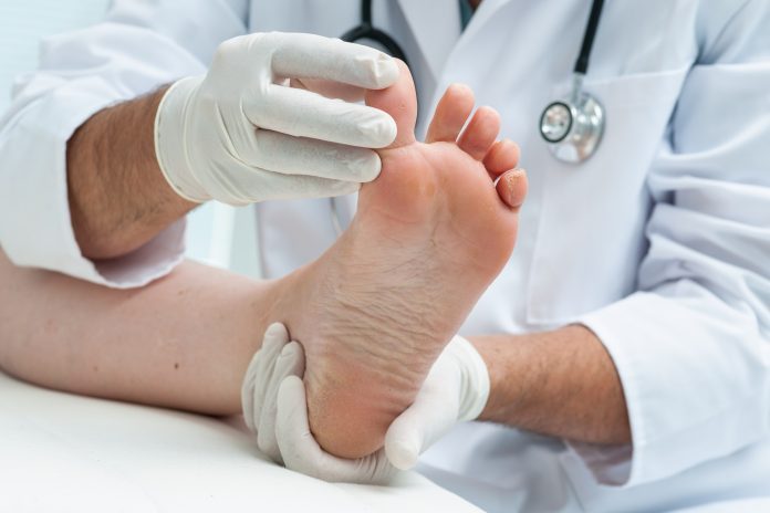 Toenail Fungus Types, Symptoms, and How to Treat Them