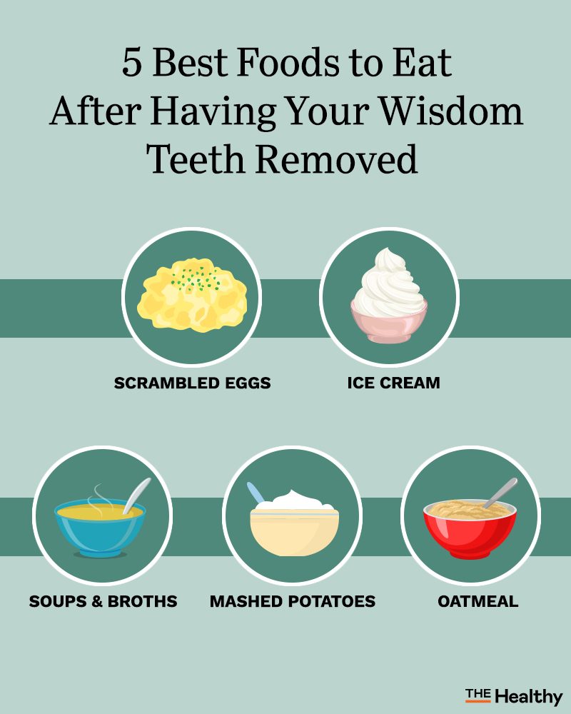 what to eat after wisdom teeth removal