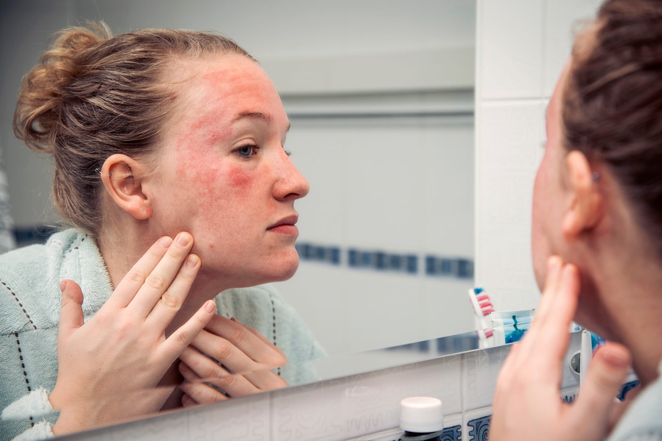 7 Reasons You Get Hives on Your Face—and What to Do About Them