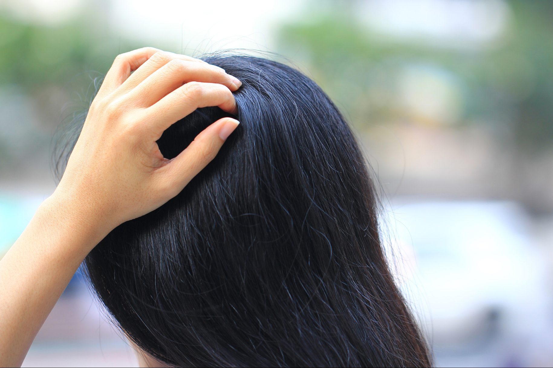 Is It Scalp Psoriasis or Dandruff? Here’s How to Tell the Difference
