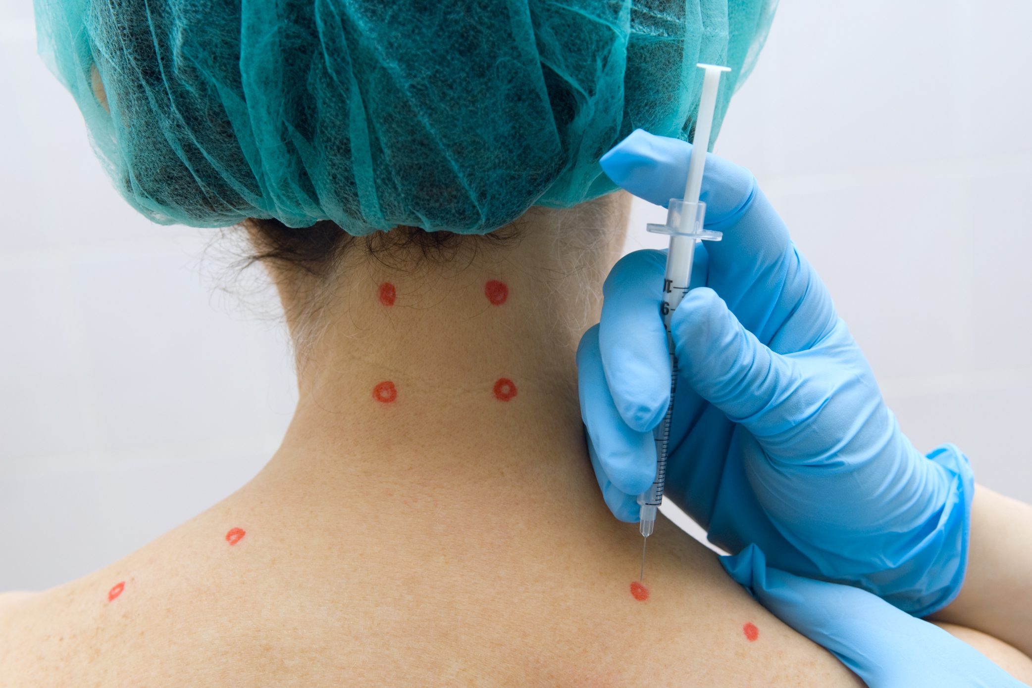 Can Trigger Point Injections Treat Your Pain?