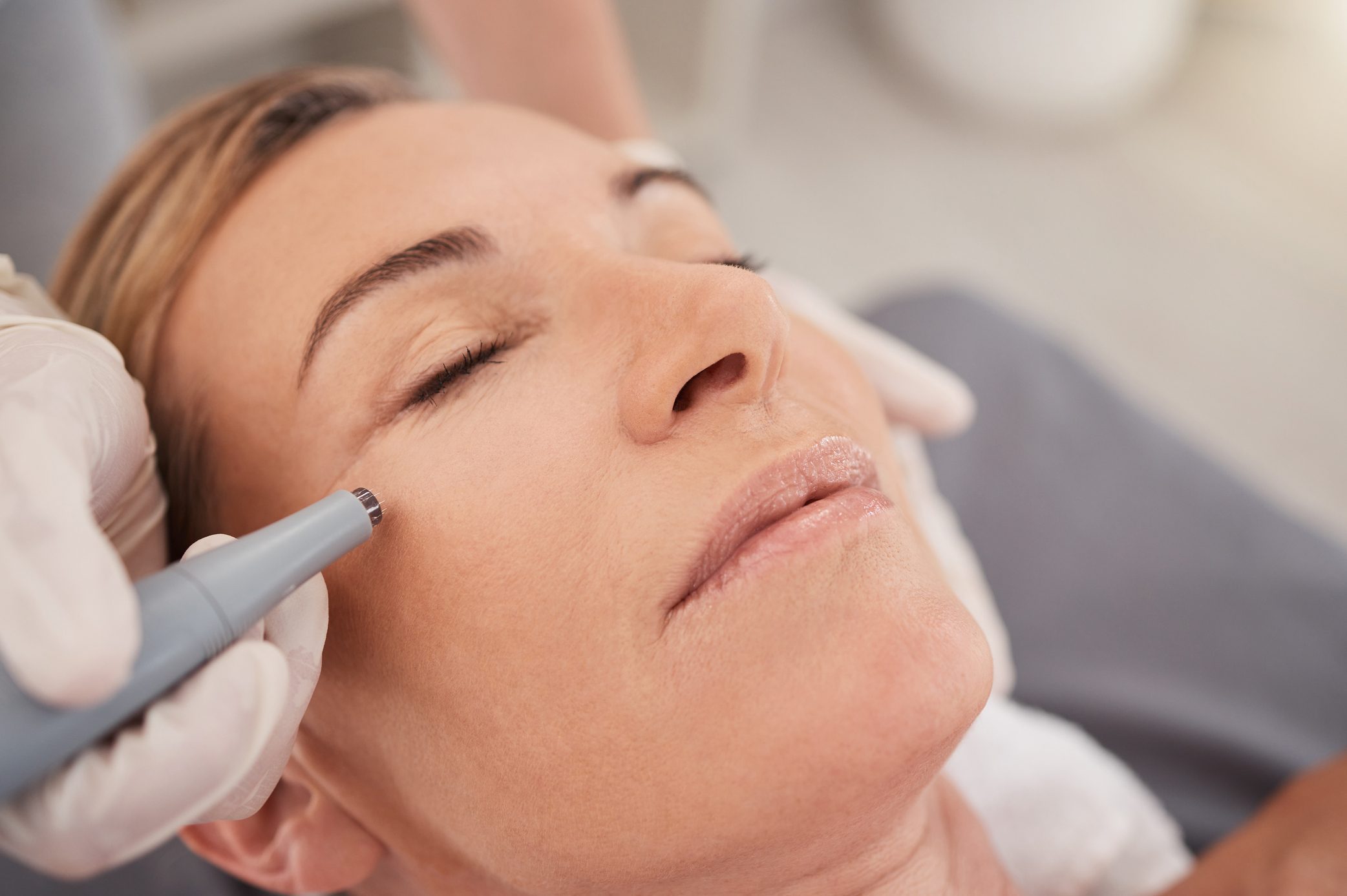 Skin-Tightening Treatments in 2023 That Can Take Years Off Your Face
