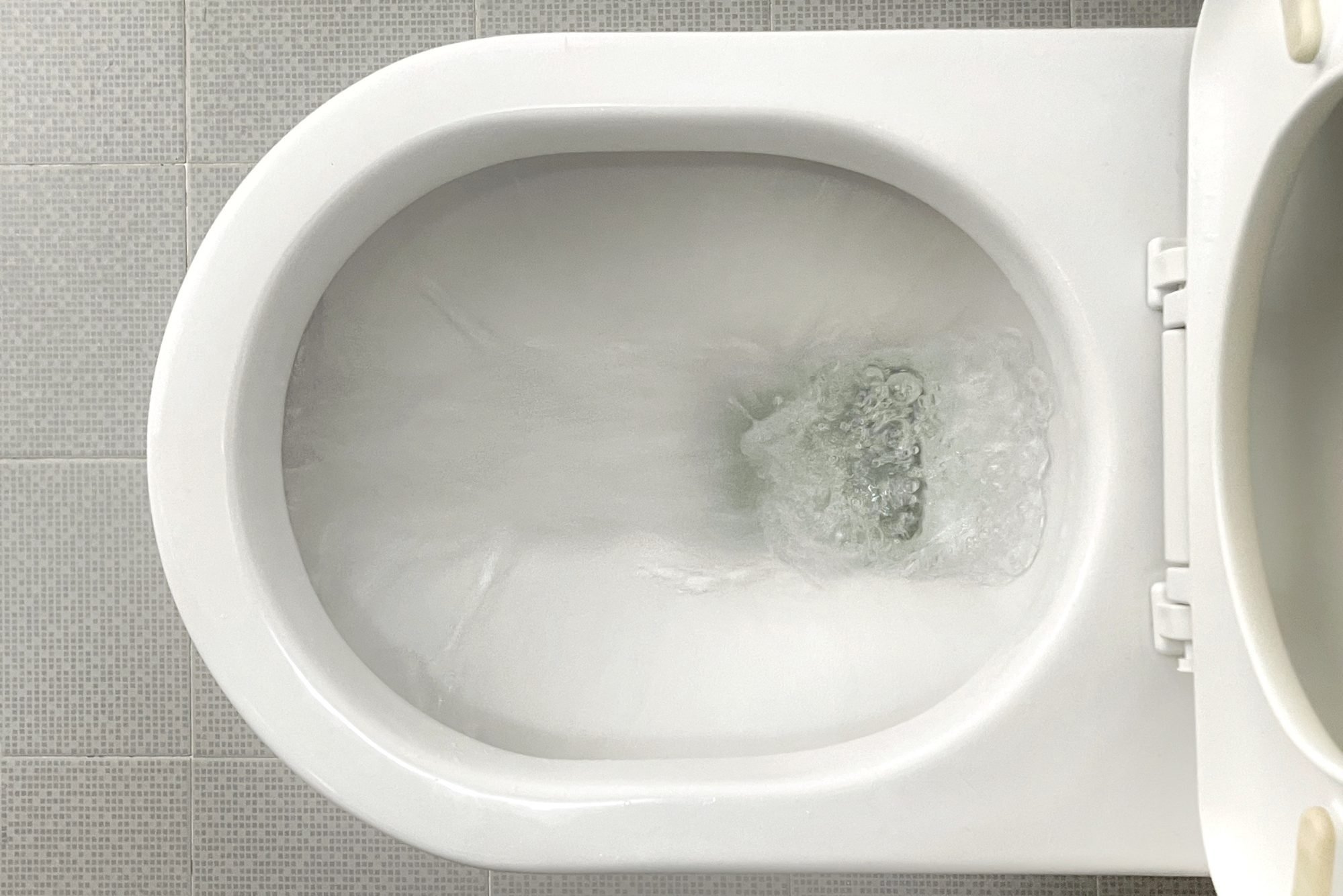 6 Things That Can Cause Bright Yellow or Green Pee, from Urologists