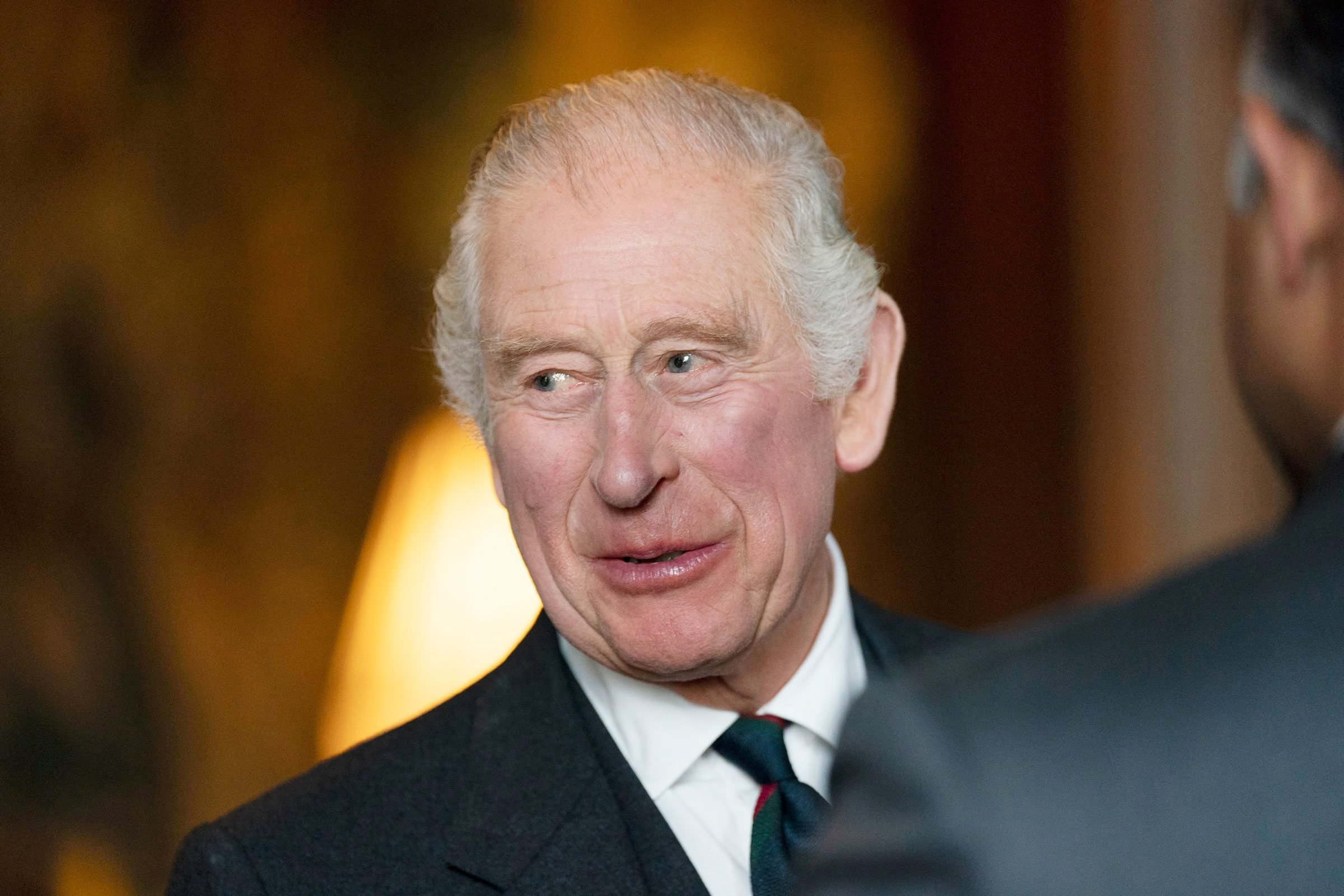 Is King Charles III Healthy? Here's How One Doctor Interprets the Clues