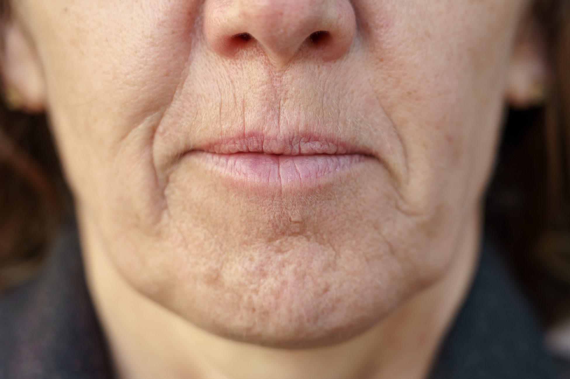What Your Facial Wrinkles May Be Trying to Tell You | The Healthy
