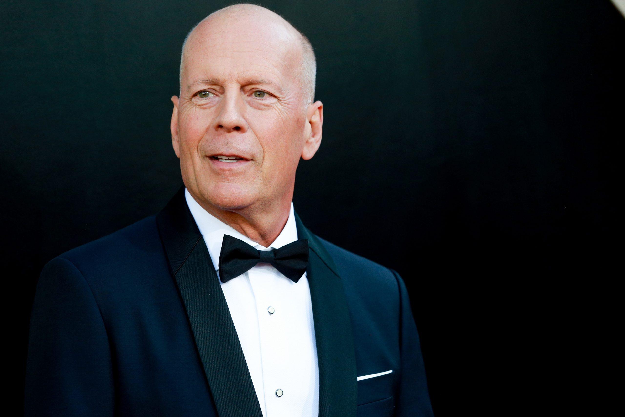 What Is Frontotemporal Dementia? Bruce Willis' Condition, Explained.