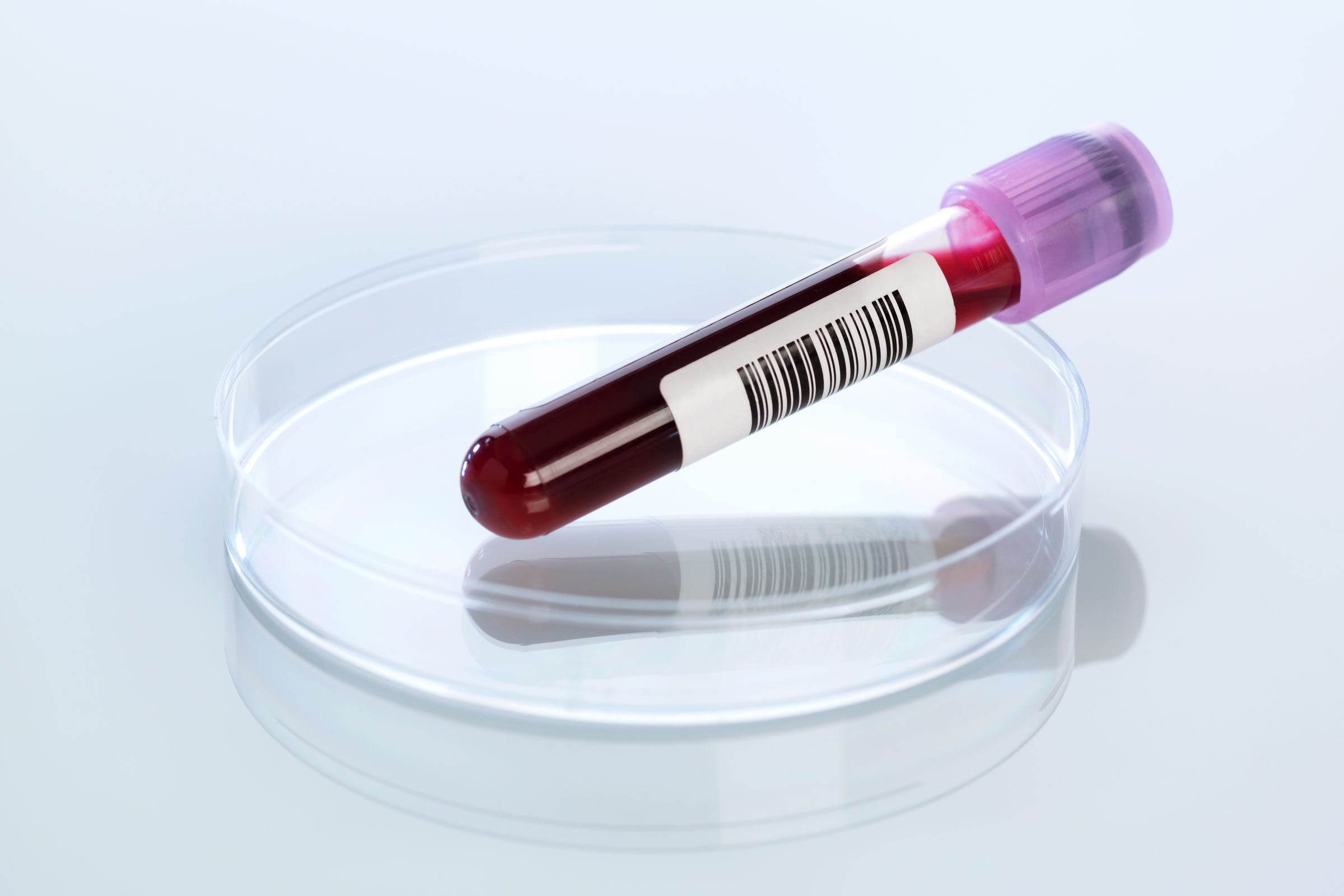 This Simple New Blood Test Can Detect Alzheimer's Risk with 96% Accuracy