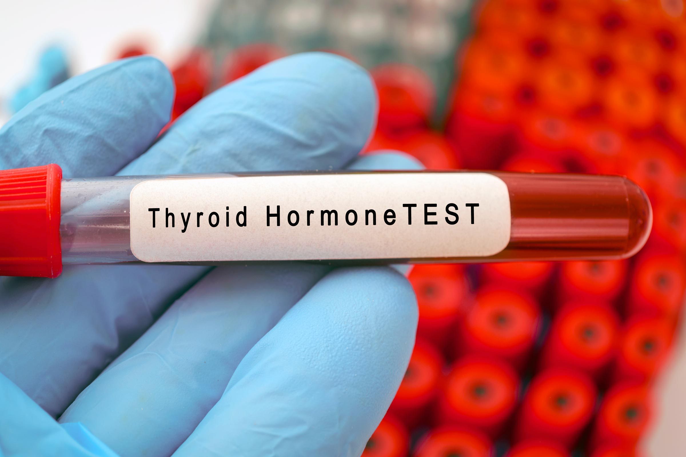Do You Have an Under-active Thyroid? This 90-Second Quiz Helps You Find Out