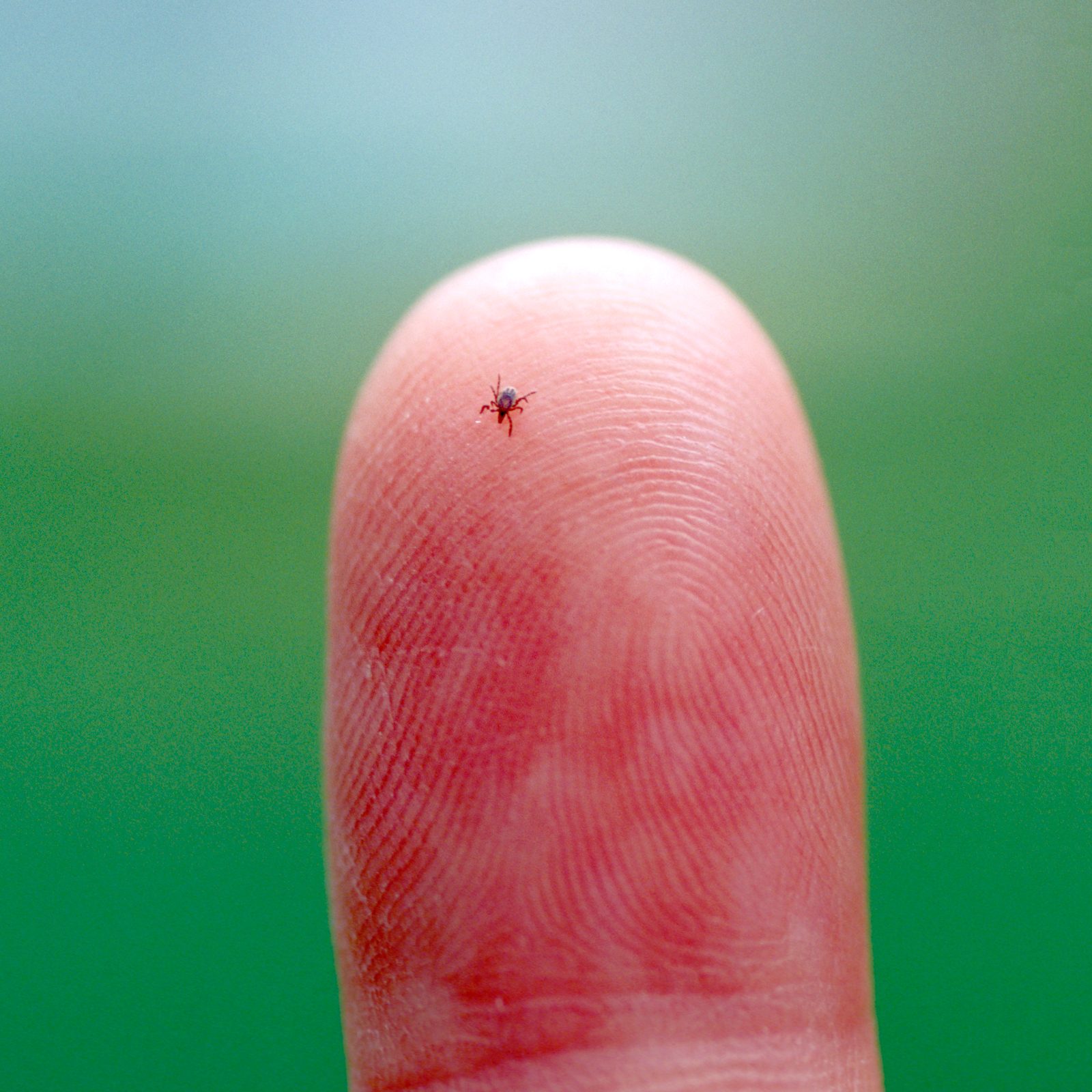 Here's Why There Are So Many Ticks This Summer, Say Experts