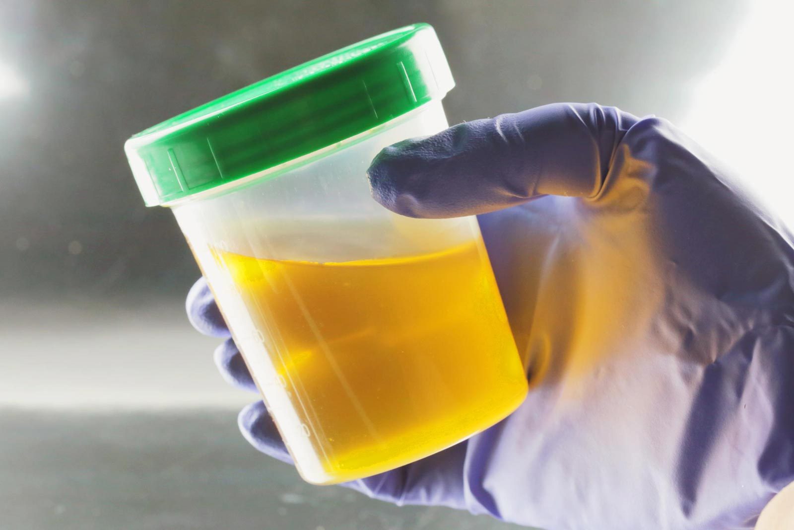 Why Is Pee Yellow? Science Just Revealed the Answer