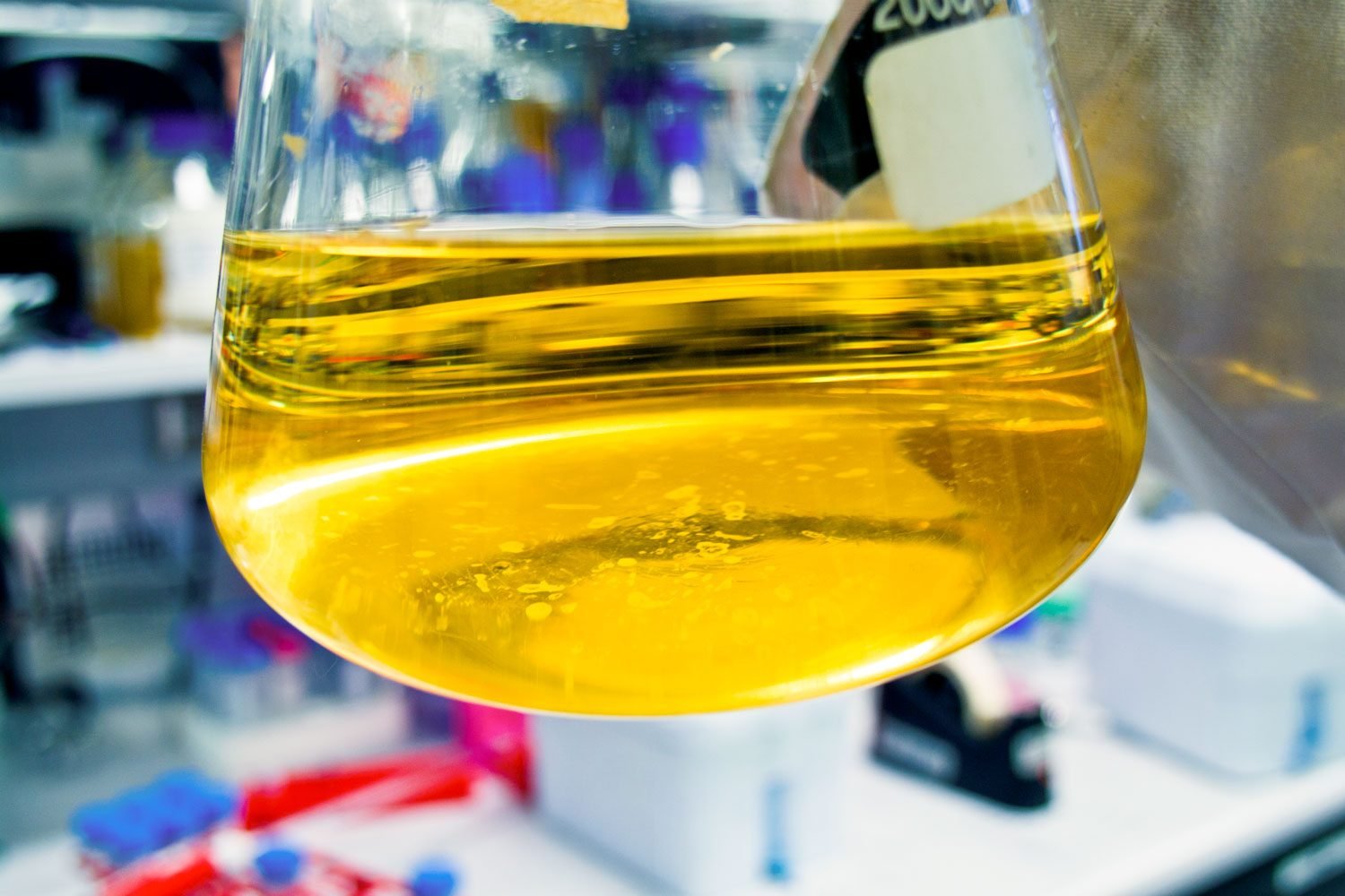 Particles in Urine: Ever Notice Them? A Doctor Shares 10 Reasons To Be Aware Of
