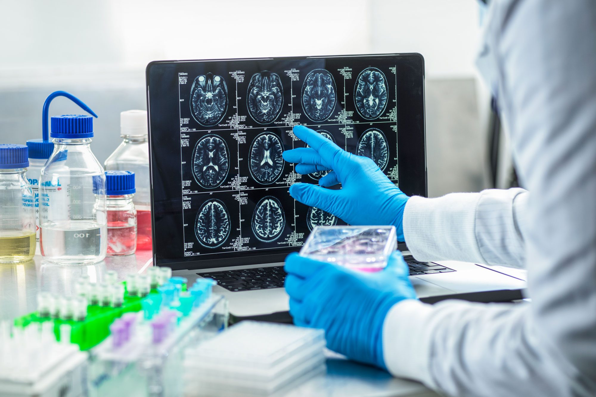 Doctor Viewing A Patients Brain Scan During Clinical Tests In The Lab